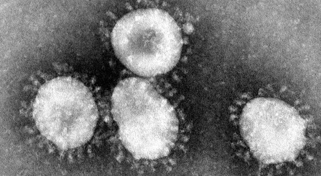 slide 67: coronavirus